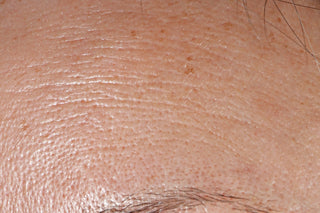 STEM CELLULAR™ Anti-Wrinkle Moisturizer Clinically Validated Results: Before, Lots of Wrinkles