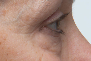 STEM CELLULAR™ Anti-Wrinkle Booster Serum Clinically Validated Results: After, Reduced Wrinkles