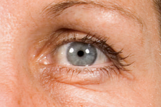 STEM CELLULAR™ Anti-Wrinkle Clinical Results Before Image: Lines Around Eyes
