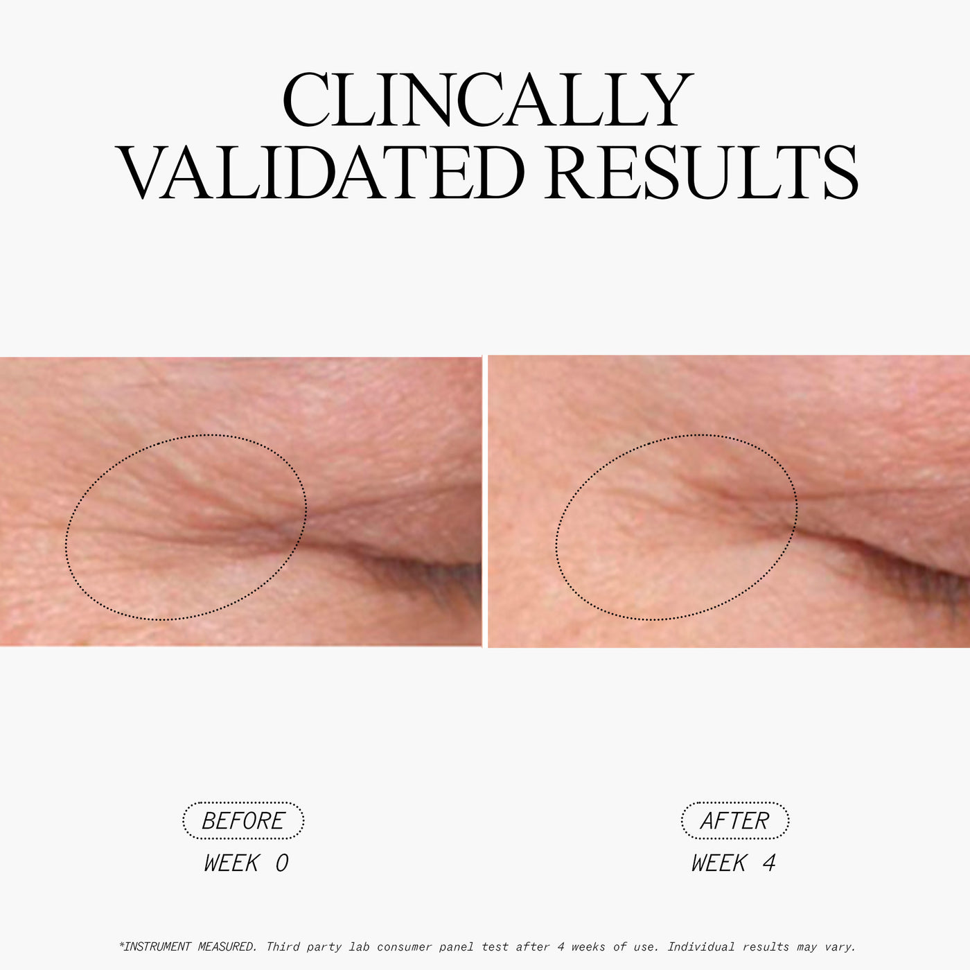 Stem Cellular Anti-Wrinkle Retinol Overnight Serum Clinically Validated Results