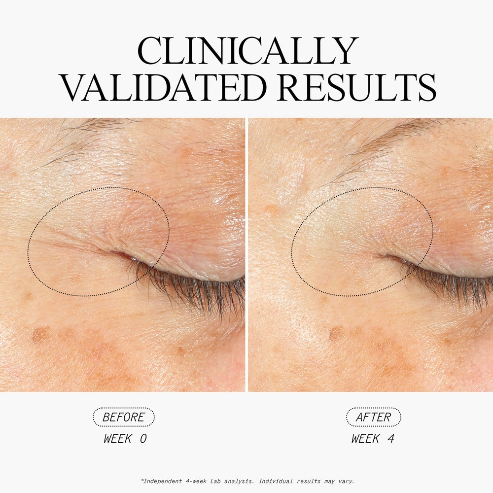 Stem Cellular SleepWrinkle Retinol Overnight Eye Cream Clinically Validated Results