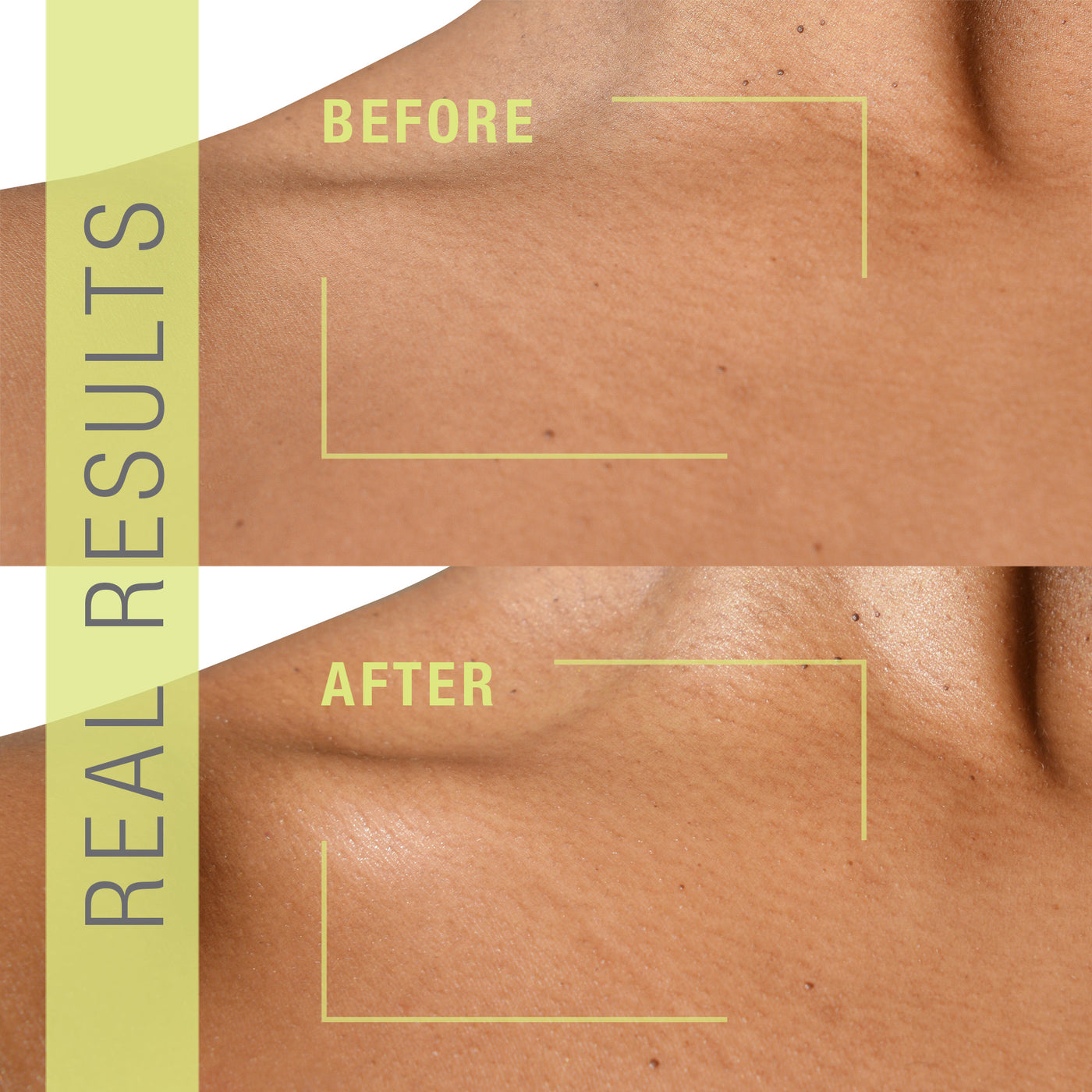 PREBIOTIX 10% Vitamin C Complex Glow Body Lotion Before & After Results