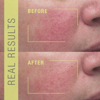 STEM CELLULAR Anti-Wrinkle Booster Serum Before & After Results