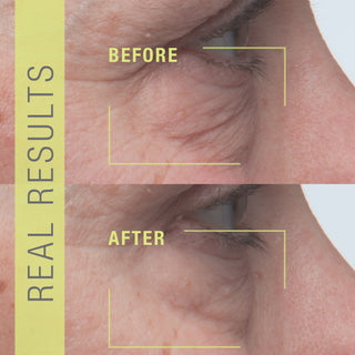 STEM CELLULAR Anti-Wrinkle Booster Serum Before & After Results