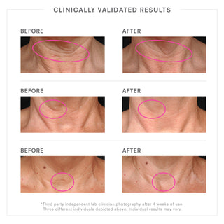 STEM CELLULAR Lifting Neck Cream Clinically Validated Results
