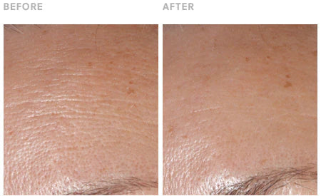 Prevent Wrinkles: 8 Effective Tips for Youthful Skin Prevent Wrinkles: 8 Effective Tips for Youthful Skin