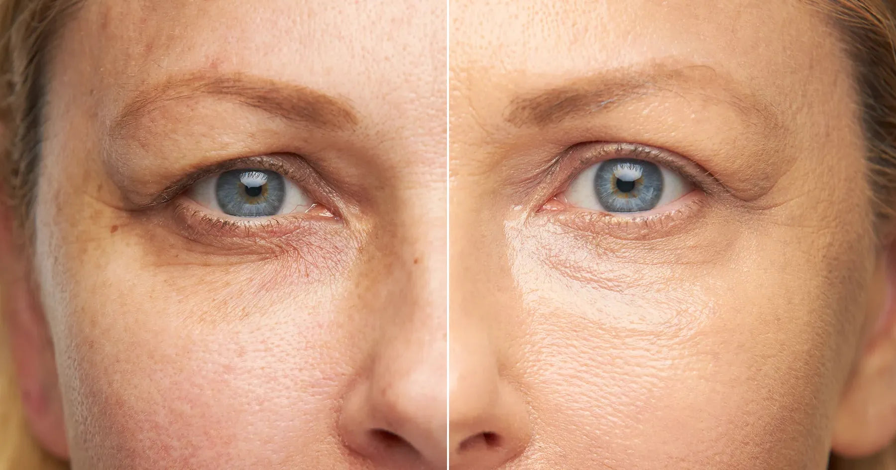 Redness on Your Face: 8 Effective Tips to Eliminate It Redness on Your Face: 8 Effective Tips to Eliminate It