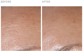 STEM CELLULAR Anti Wrinkle Moisturizer Clinically Validated Results: Reduced Wrinkles before and after images