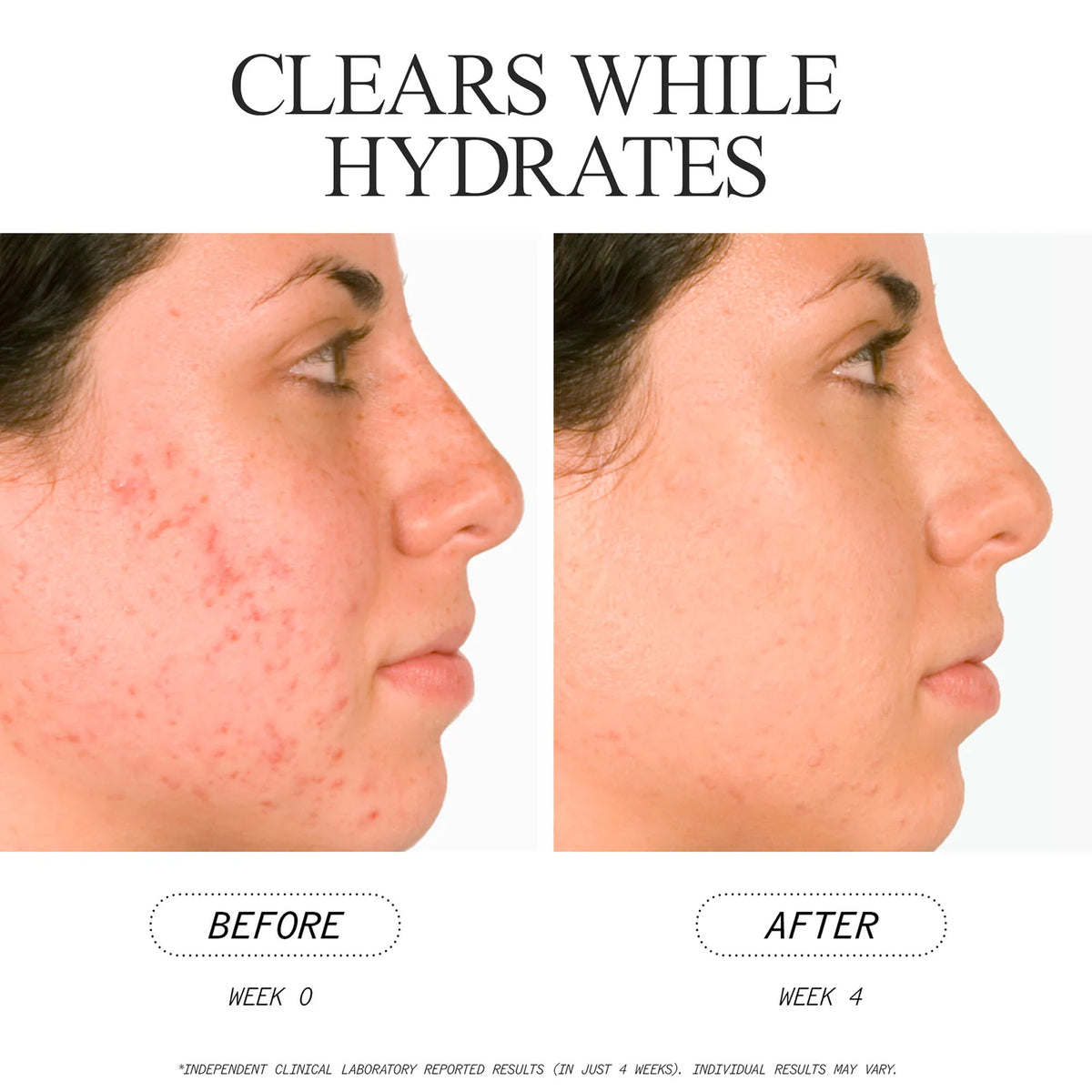 Blemish Clearing Cleanser