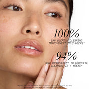 Oil-Free Moisturizer