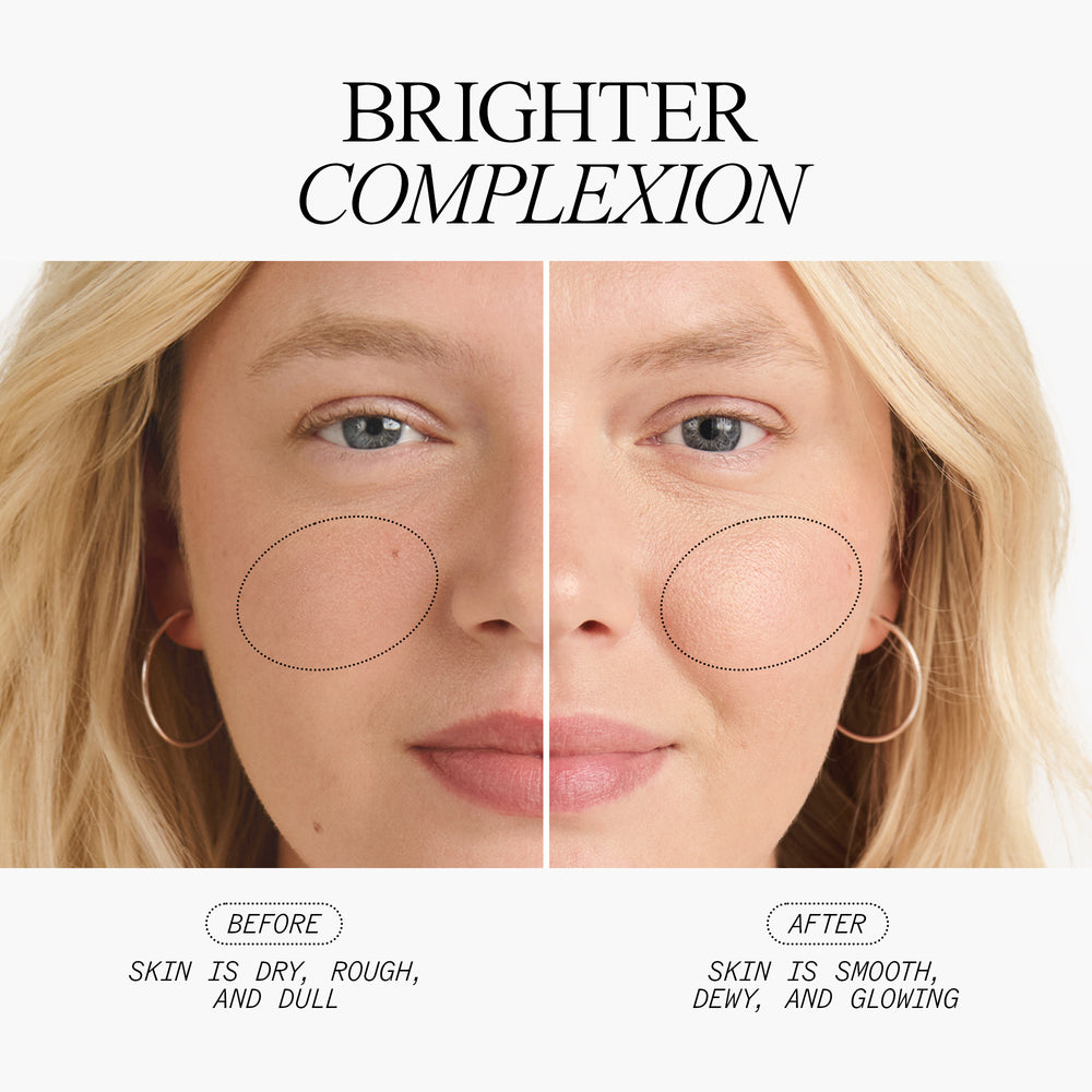 Brighter Complexion