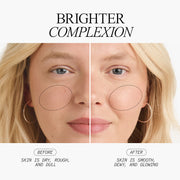 Brighter Complexion