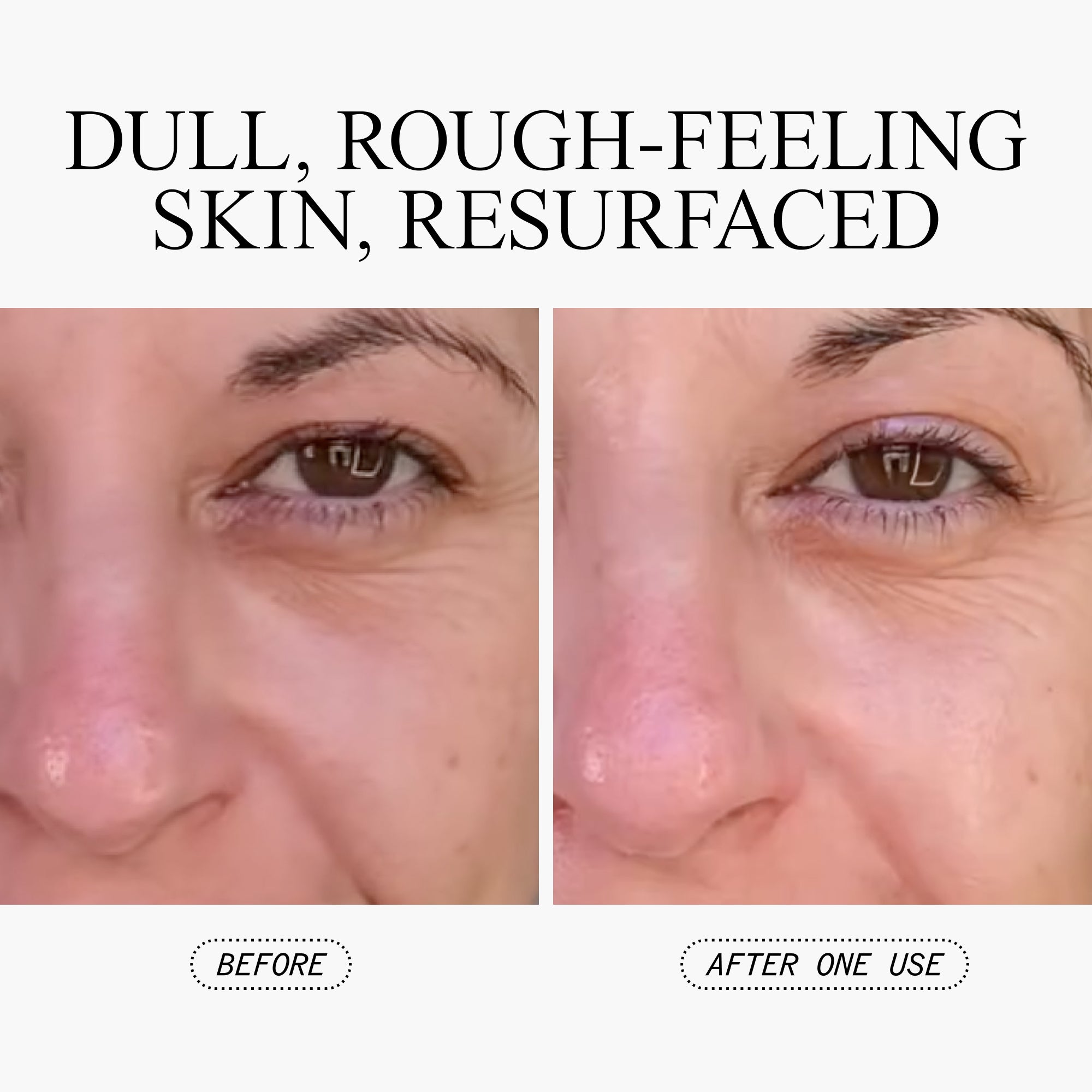 Pulverizador Peeling Exfoliante