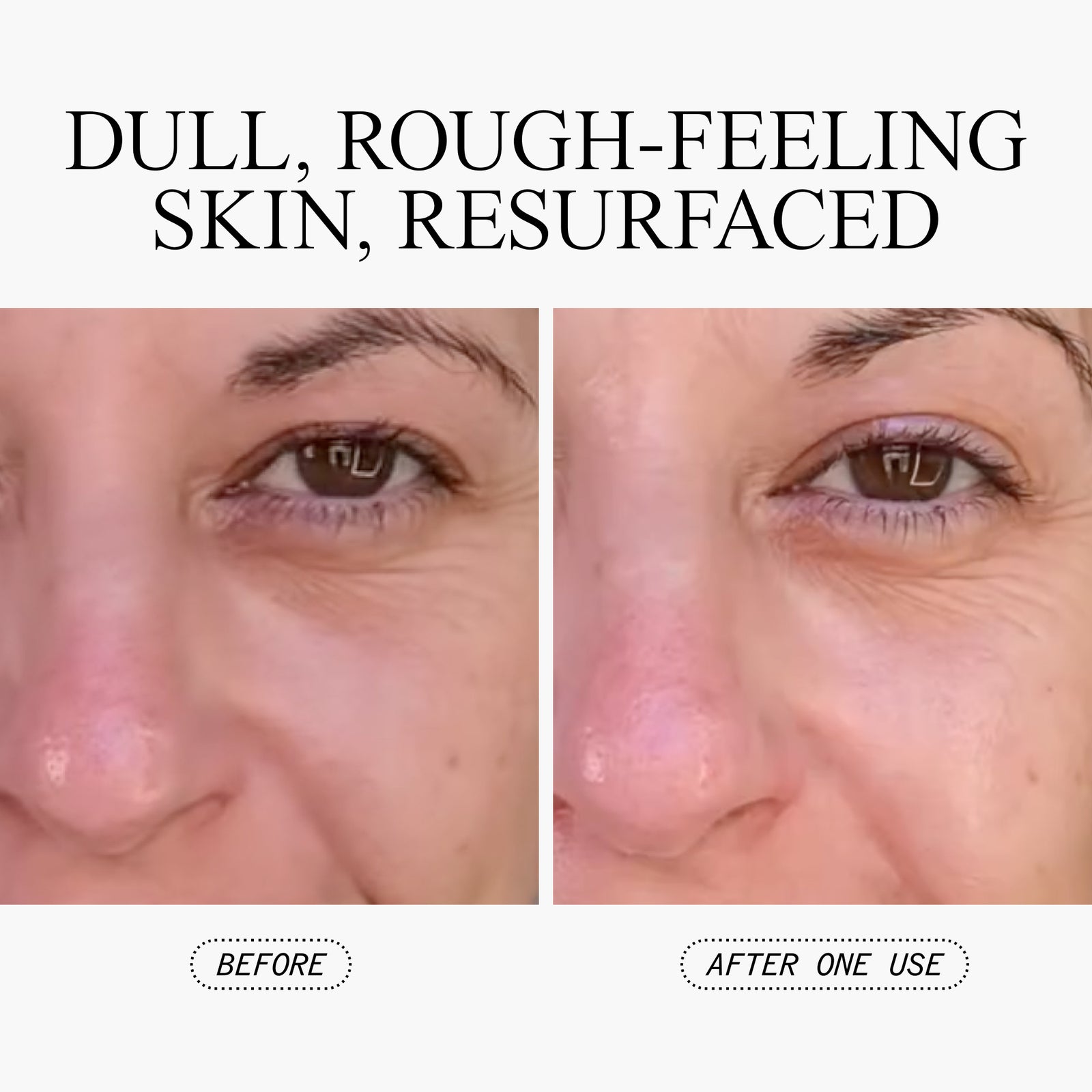 Exfoliating Peel Spray