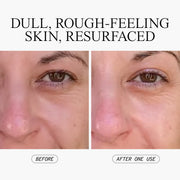Exfoliating Peel Spray