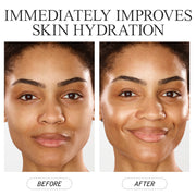 Prebiotix C-Boost72 Whipped Moisturizer Immediately Improves Skin Hydration