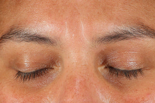 PREBIOTIX™ Freshly Squeezed Glow, 20% Vitamin C Serum Clinically Validated Results: Before, Wrinkles Between the Eyebrows
