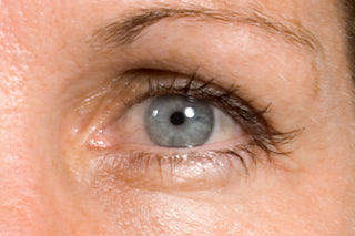 STEM CELLULAR™ Anti-Wrinkle Clinical Results After Image: Reduced Lines Around Eyes