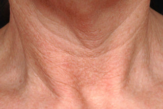 STEM CELLULAR™ Anti-Wrinkle Lifting Neck Cream Clinically Validated Results: After, Reduced Wrinkles