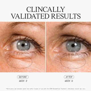 Stem Cellular Anti-Wrinkle Eye Treatment Clinically Validated Results