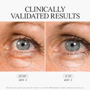 Stem Cellular Anti-Wrinkle Eye Treatment Clinically Validated Results