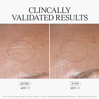 Stem Cellular Anti-Wrinkle Moisturizer Clinically Validated Results