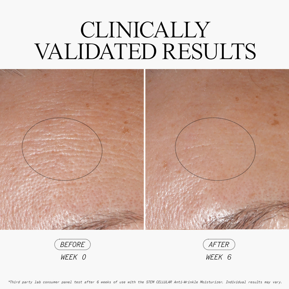 Stem Cellular Anti-Wrinkle Moisturizer Clinically Validated Results