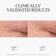 Stem Cellular Anti-Wrinkle Retinol Overnight Serum Clinically Validated Results