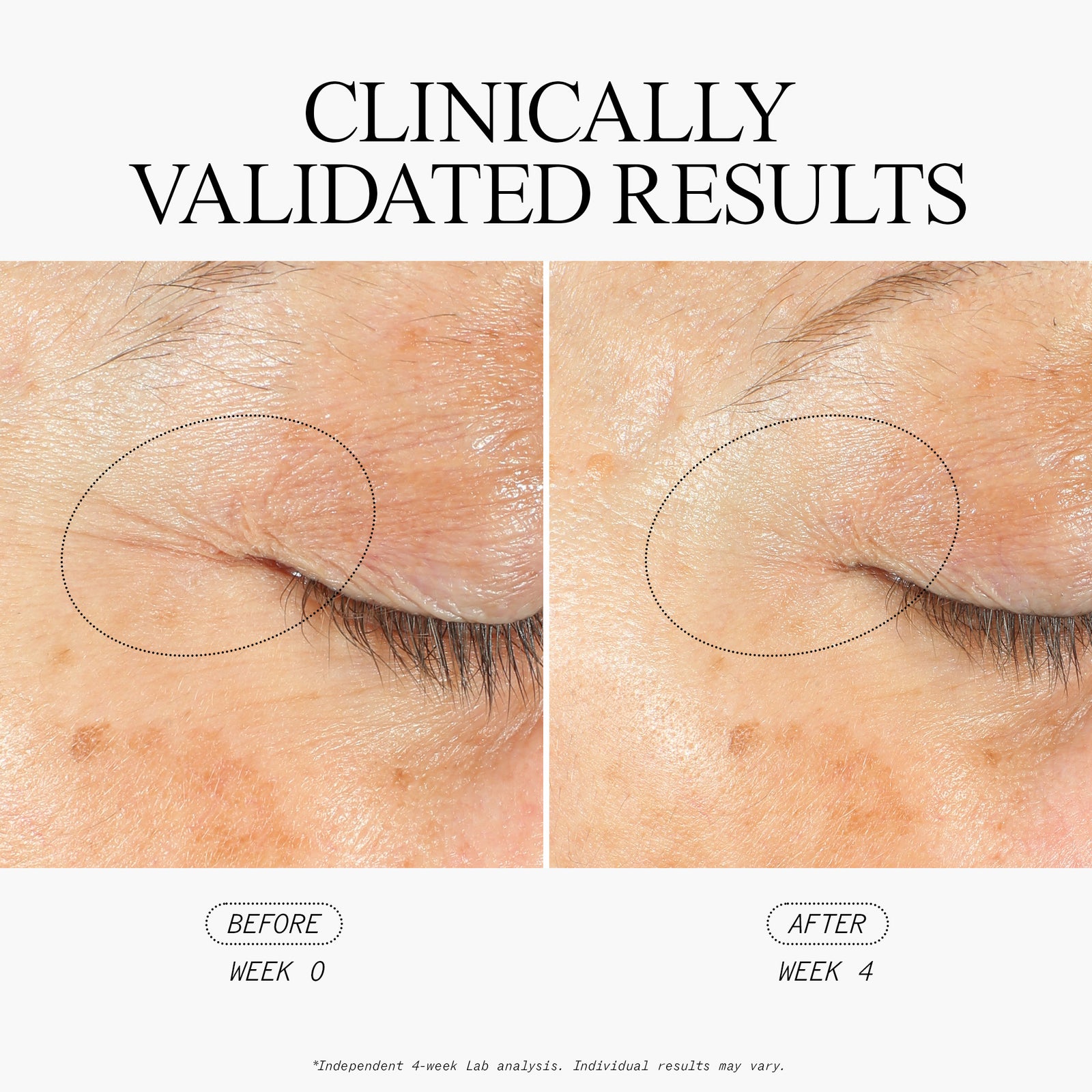 Stem Cellular SleepWrinkle Retinol Overnight Eye Cream Clinically Validated Results