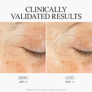 Stem Cellular SleepWrinkle Retinol Overnight Eye Cream Clinically Validated Results