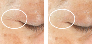 STEM CELLULAR SleepWrinkle Retinol Overnight Eye Cream Before and After Clinically Validated Results