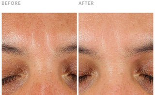 Images of Clinically Validated Results using Vitamin C: Reduced Wrinkles