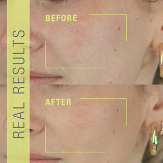STEM CELLULAR Exfoliating Peel Spray Before and After Results