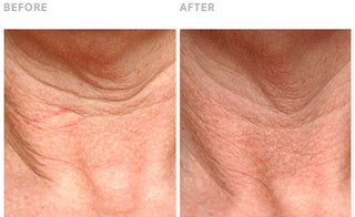 STEM CELLULAR Anti Wrinkle Lifting Neck Cream Clinically Validated Results: Reduced Wrinkles