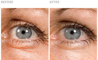 Clinically Validated Results: Reduced Wrinkles