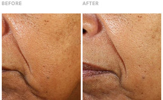 Clinically Validated Results: Reduced Wrinkles