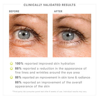 STEM CELLULAR Vinifera Replenishing Oil and STEM CELLULAR Anti-Wrinkle Eye Treatment set Clinically Validated Results