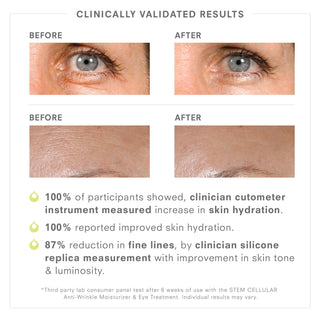 Anti-Wrinkle Serum, Moisturizer and Eye Treatment Set Clinically Validated Results